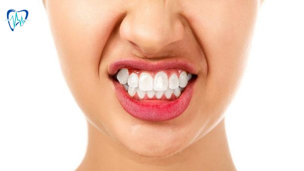 Stress, Bruxism, and Dental Checkups: Protecting Your Teeth from Unconscious Grinding